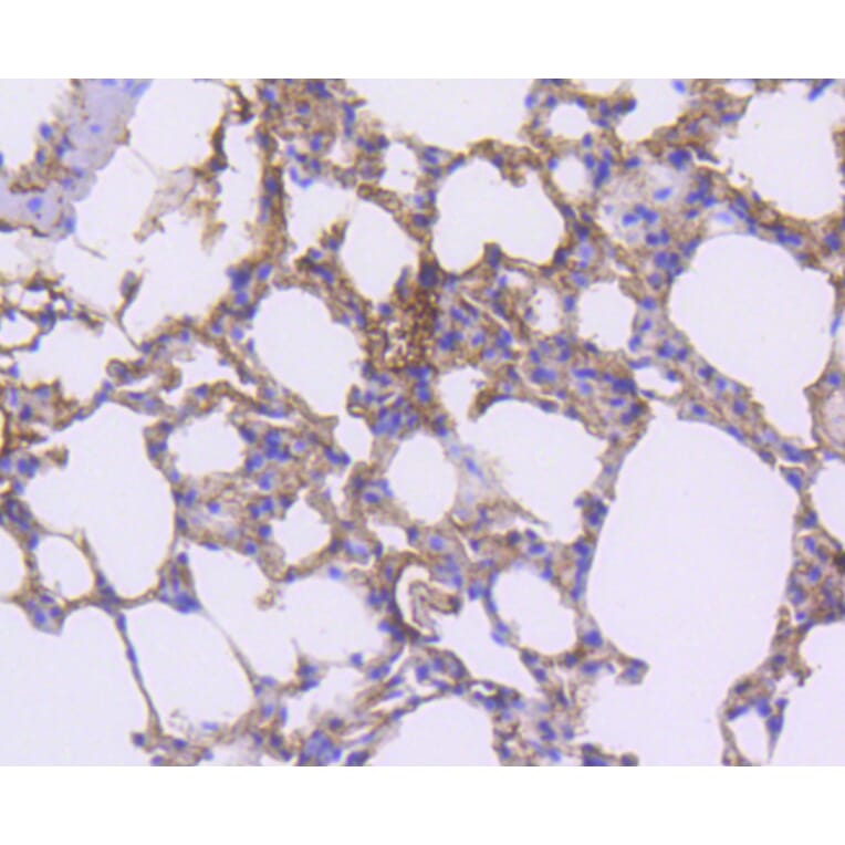 Immunohistochemistry - Anti-PDGFRB Antibody (A11071) - Antibodies.com