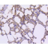 Immunohistochemistry - Anti-PDGFRB Antibody (A11071) - Antibodies.com