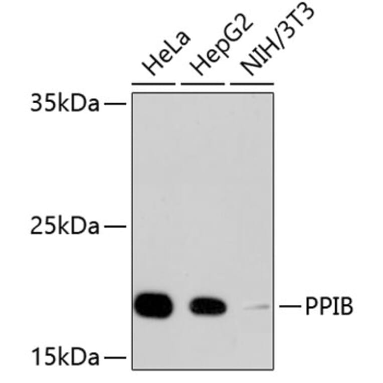 Western Blot - Anti-PPIB Antibody (A11095) - Antibodies.com
