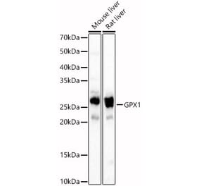 Western Blot - Anti-Glutathione Peroxidase 1 Antibody (A13224) - Antibodies.com