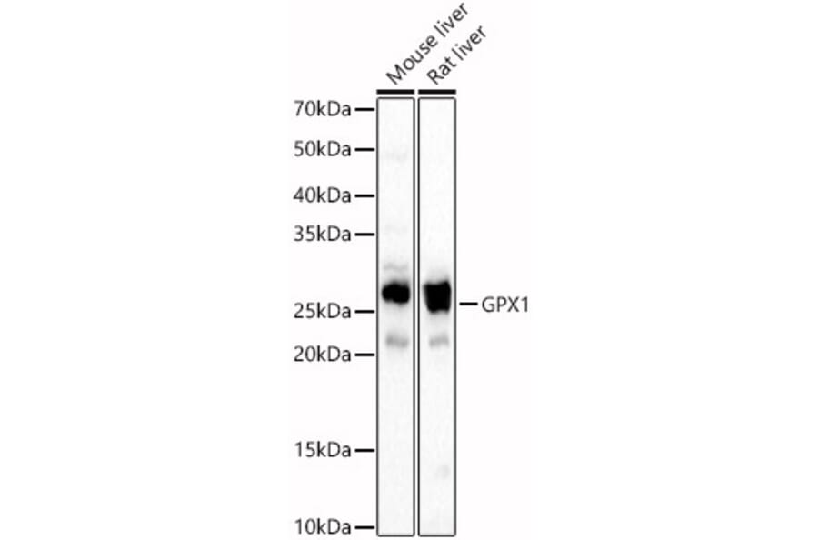 Western Blot - Anti-Glutathione Peroxidase 1 Antibody (A13224) - Antibodies.com