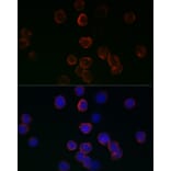 Immunofluorescence - Anti-Glutathione Peroxidase 1 Antibody (A13224) - Antibodies.com