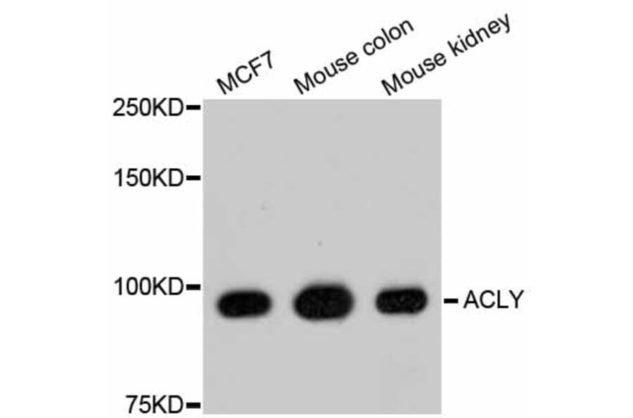 Western Blot - Anti-ACLY Antibody (A11105) - Antibodies.com