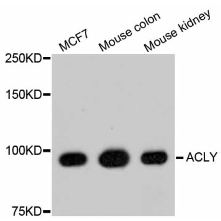 Western Blot - Anti-ACLY Antibody (A11105) - Antibodies.com