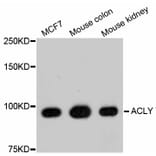 Western Blot - Anti-ACLY Antibody (A11105) - Antibodies.com