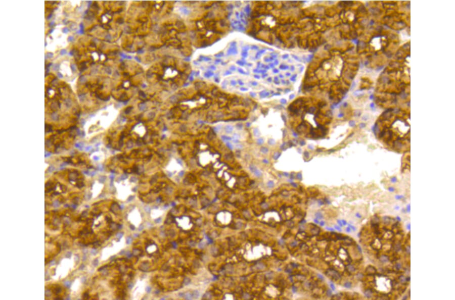 Immunohistochemistry - Anti-ACLY Antibody (A11105) - Antibodies.com