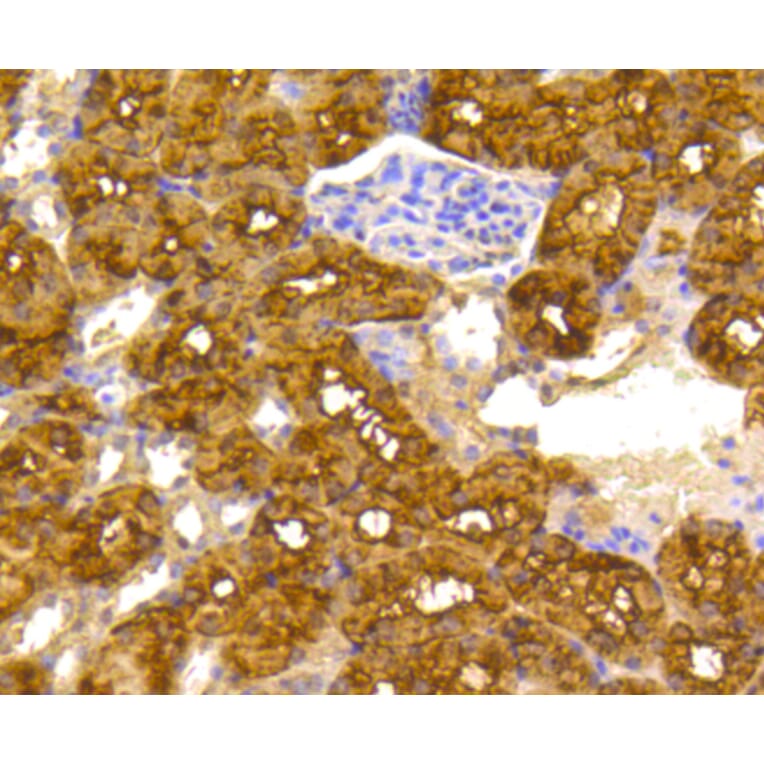 Immunohistochemistry - Anti-ACLY Antibody (A11105) - Antibodies.com