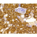 Immunohistochemistry - Anti-ACLY Antibody (A11105) - Antibodies.com