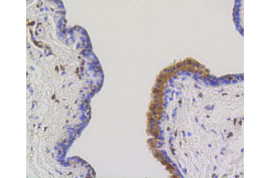 Immunohistochemistry - Anti-ACLY Antibody (A11105) - Antibodies.com
