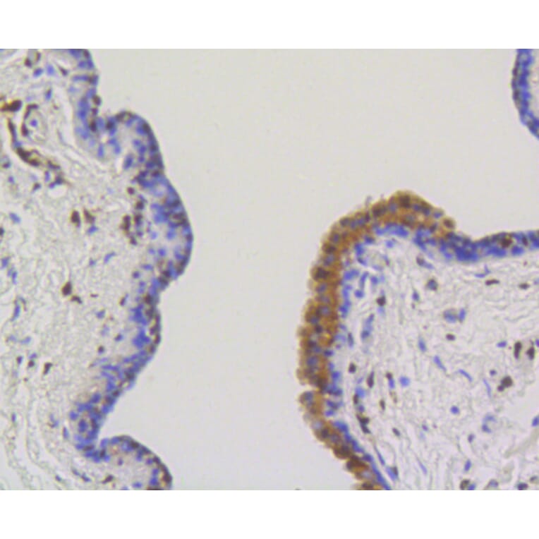 Immunohistochemistry - Anti-ACLY Antibody (A11105) - Antibodies.com