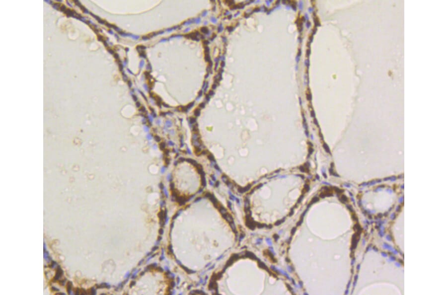 Immunohistochemistry - Anti-ACLY Antibody (A11105) - Antibodies.com