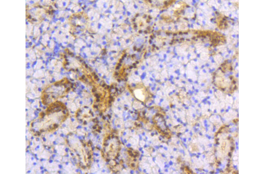 Immunohistochemistry - Anti-ACLY Antibody (A11105) - Antibodies.com