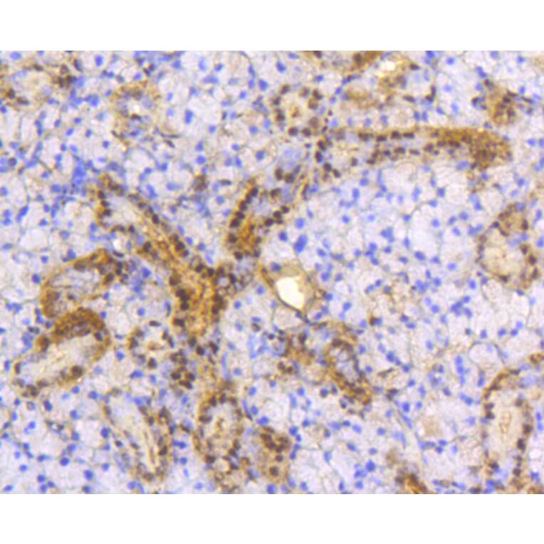 Immunohistochemistry - Anti-ACLY Antibody (A11105) - Antibodies.com