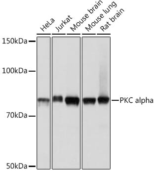 Western blot analysis of extracts of various cell lines, using Anti-PRKCA Antibody (A11107).
Secondary antibody: Goat Anti-Rabbit IgG (H+L) (HRP) (AS014) at 1:10,000 dilution.
Lysates / proteins: 25µg per lane.
Blocking buffer: 3% non-fat dry milk in TBST.
