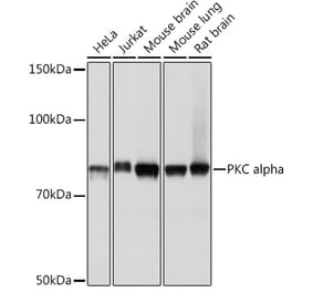 Western Blot - Anti-PKC alpha Antibody [ARC0197] (A13227) - Antibodies.com