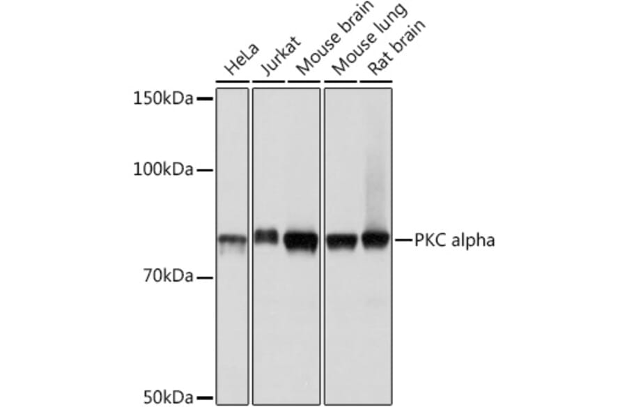 Western Blot - Anti-PKC alpha Antibody [ARC0197] (A13227) - Antibodies.com