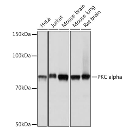 Western Blot - Anti-PKC alpha Antibody [ARC0197] (A13227) - Antibodies.com