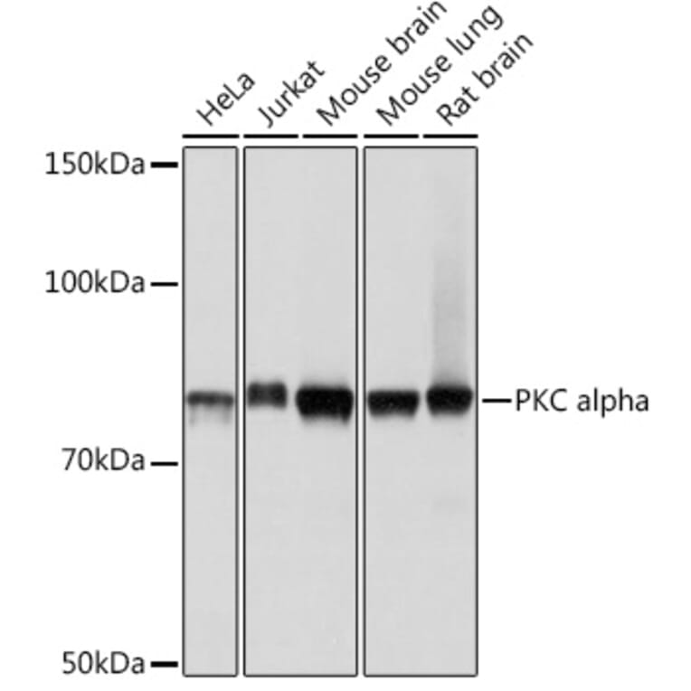 Western Blot - Anti-PKC alpha Antibody [ARC0197] (A13227) - Antibodies.com