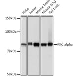 Western Blot - Anti-PKC alpha Antibody [ARC0197] (A13227) - Antibodies.com
