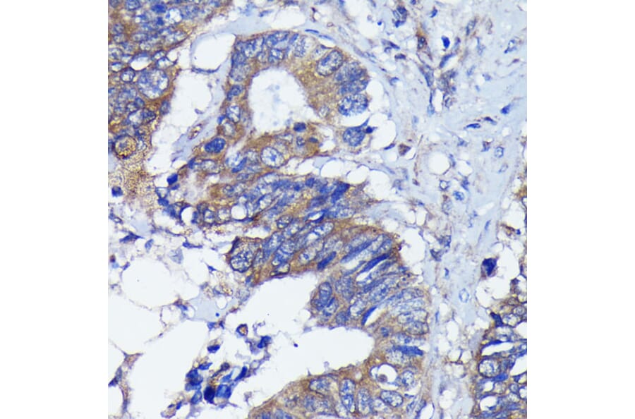 Immunohistochemistry - Anti-PKC alpha Antibody [ARC0197] (A13227) - Antibodies.com
