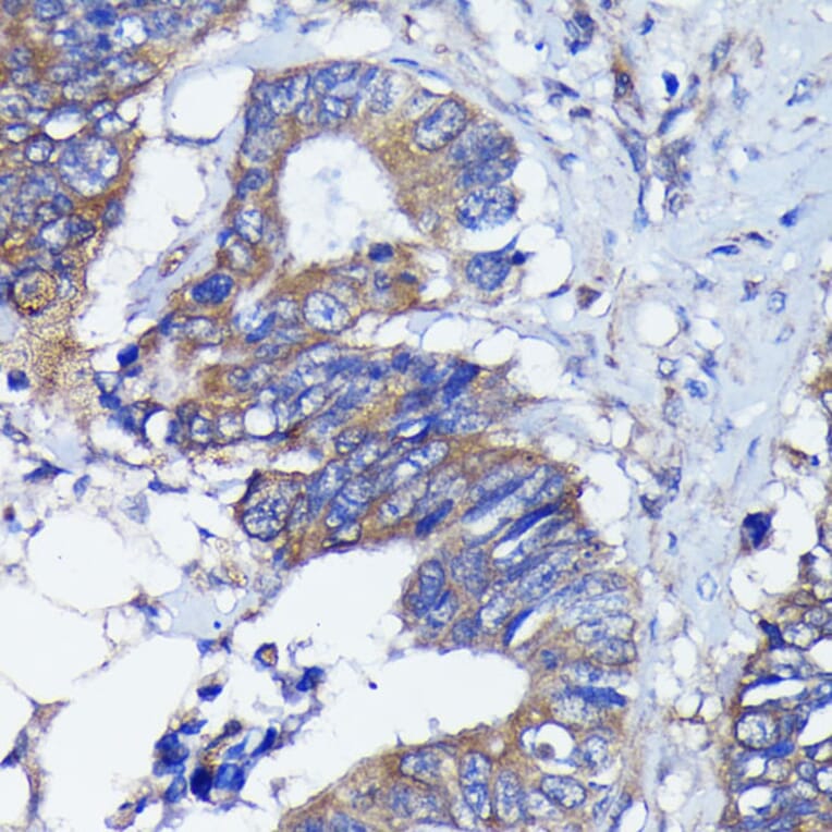Immunohistochemistry - Anti-PKC alpha Antibody [ARC0197] (A13227) - Antibodies.com