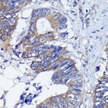 Immunohistochemistry - Anti-PKC alpha Antibody [ARC0197] (A13227) - Antibodies.com