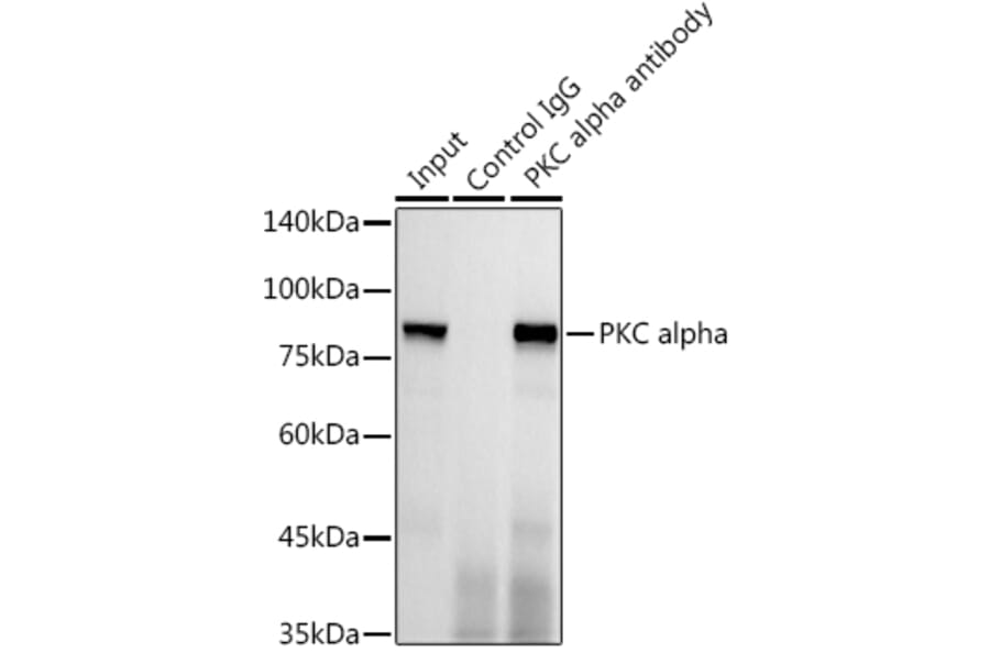 Western Blot - Anti-PKC alpha Antibody [ARC0197] (A13227) - Antibodies.com