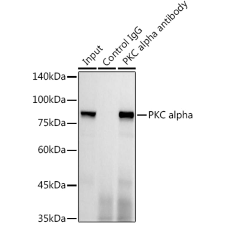 Western Blot - Anti-PKC alpha Antibody [ARC0197] (A13227) - Antibodies.com