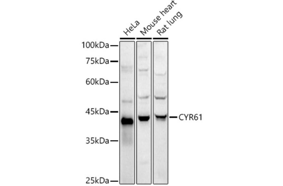 Western Blot - Anti-CYR61/CCN1 Antibody (A13229) - Antibodies.com