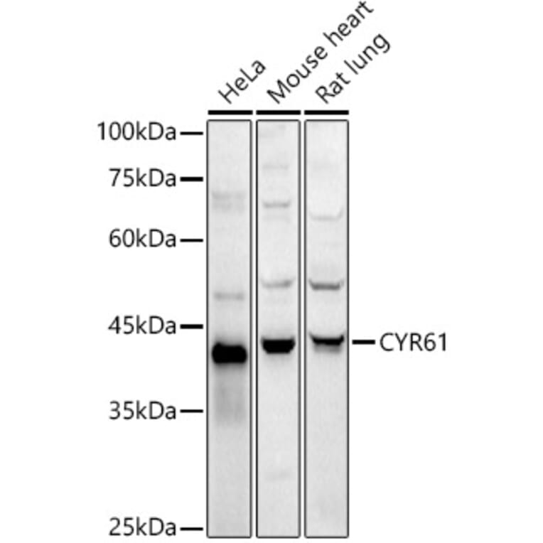 Western Blot - Anti-CYR61/CCN1 Antibody (A13229) - Antibodies.com