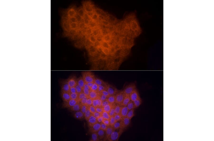 Immunofluorescence - Anti-CYR61/CCN1 Antibody (A13229) - Antibodies.com