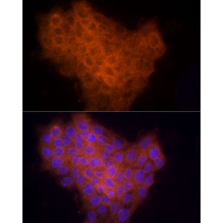 Immunofluorescence - Anti-CYR61/CCN1 Antibody (A13229) - Antibodies.com