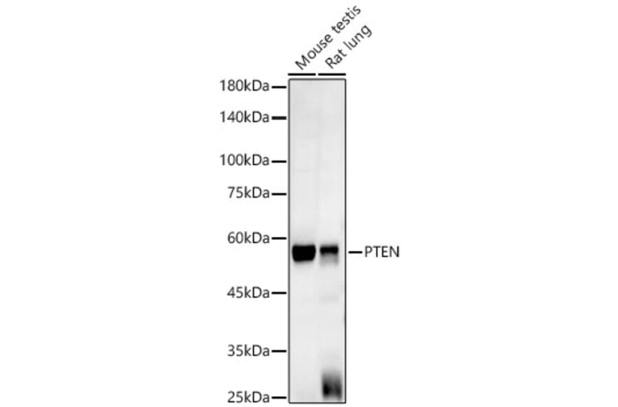 Western Blot - Anti-PTEN Antibody [AMC0179] (A13234) - Antibodies.com