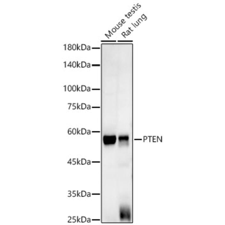 Western Blot - Anti-PTEN Antibody [AMC0179] (A13234) - Antibodies.com