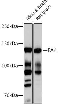 Western blot analysis of extracts of various cell lines, using Anti-PTK2 Antibody (A11131).
Secondary antibody: Goat Anti-Rabbit IgG (H+L) (HRP) (AS014) at 1:10,000 dilution.
Lysates / proteins: 25µg per lane.
Blocking buffer: 3% non-fat dry milk in TBST.