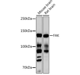 Western Blot - Anti-FAK Antibody [ARC0171] (A13236) - Antibodies.com