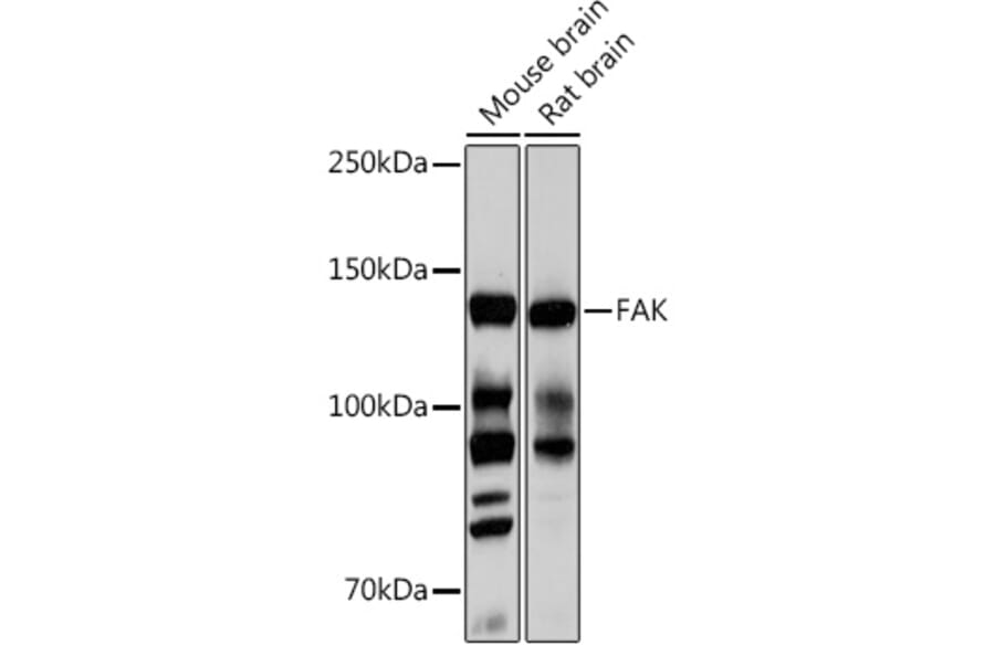 Western Blot - Anti-FAK Antibody [ARC0171] (A13236) - Antibodies.com