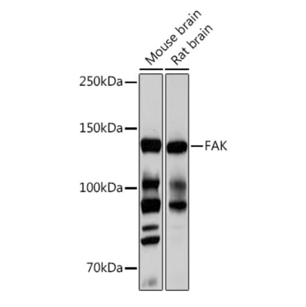 Western Blot - Anti-FAK Antibody [ARC0171] (A13236) - Antibodies.com
