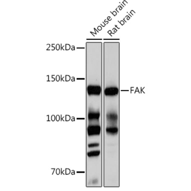 Western Blot - Anti-FAK Antibody [ARC0171] (A13236) - Antibodies.com