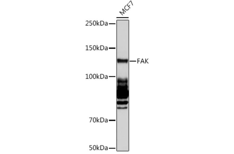 Western Blot - Anti-FAK Antibody [ARC0171] (A13236) - Antibodies.com