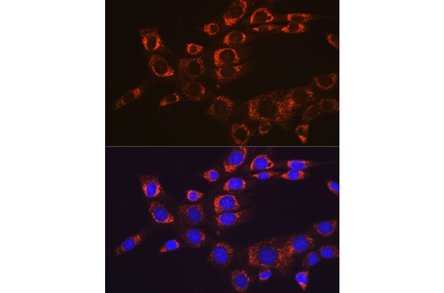 Immunofluorescence - Anti-FAK Antibody [ARC0171] (A13236) - Antibodies.com