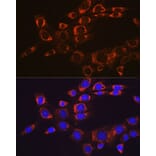 Immunofluorescence - Anti-FAK Antibody [ARC0171] (A13236) - Antibodies.com