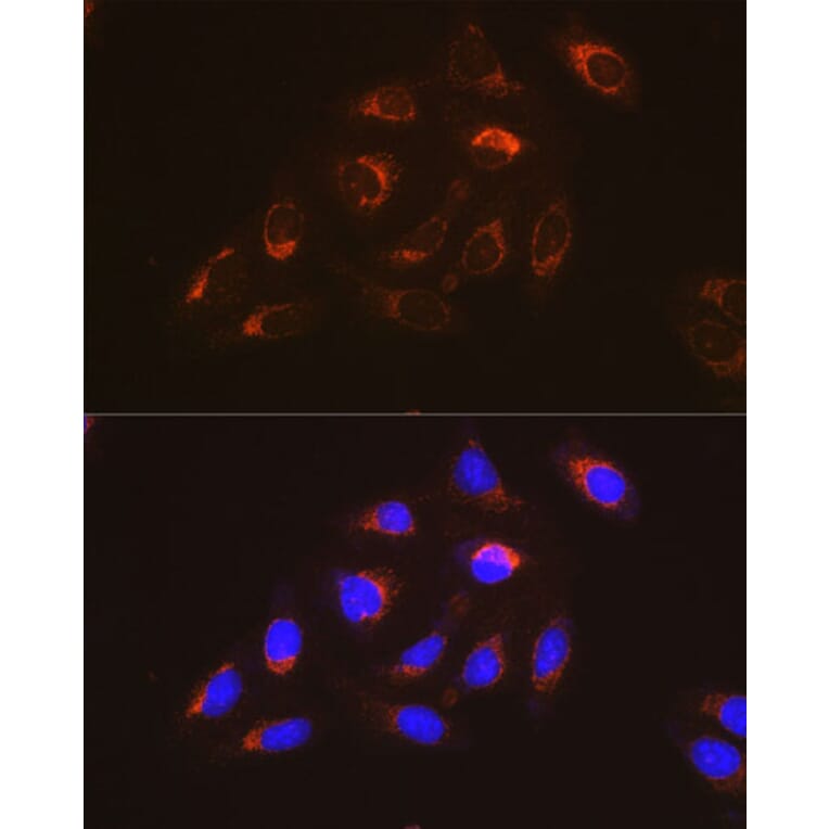 Immunofluorescence - Anti-FAK Antibody [ARC0171] (A13236) - Antibodies.com
