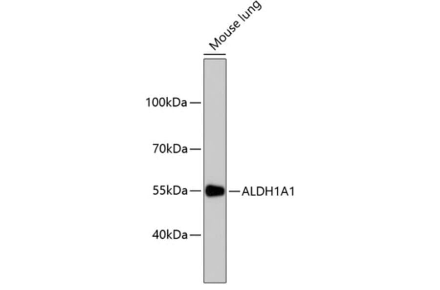 Western Blot - Anti-ALDH1A1 Antibody (A11132) - Antibodies.com