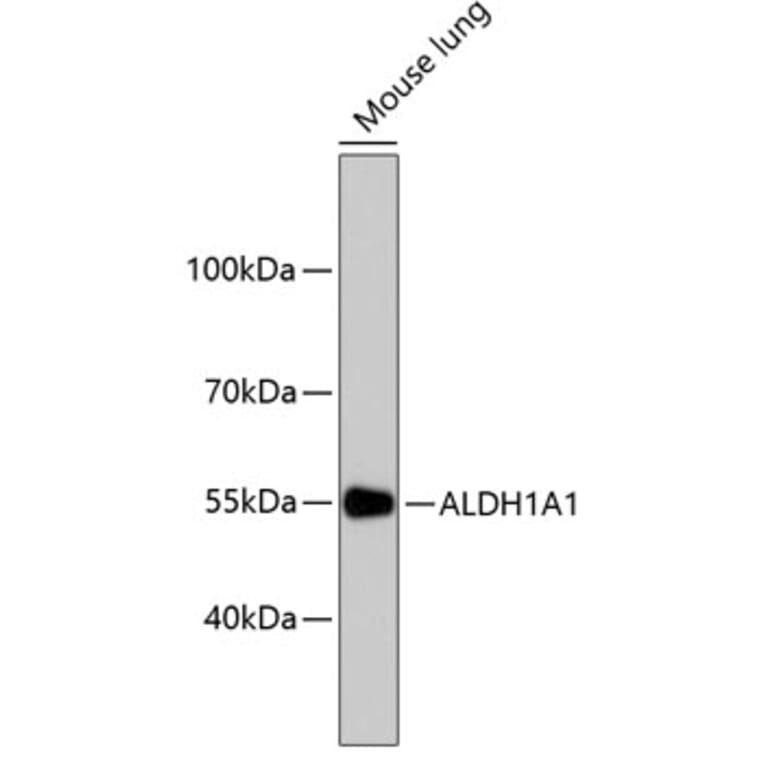 Western Blot - Anti-ALDH1A1 Antibody (A11132) - Antibodies.com