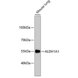 Western Blot - Anti-ALDH1A1 Antibody (A11132) - Antibodies.com
