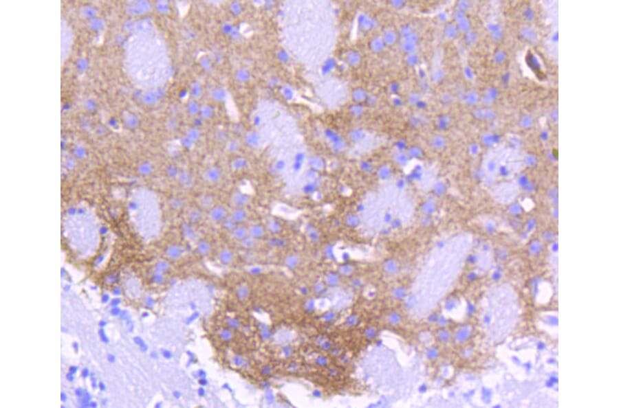 Immunohistochemistry - Anti-ALDH1A1 Antibody (A11132) - Antibodies.com