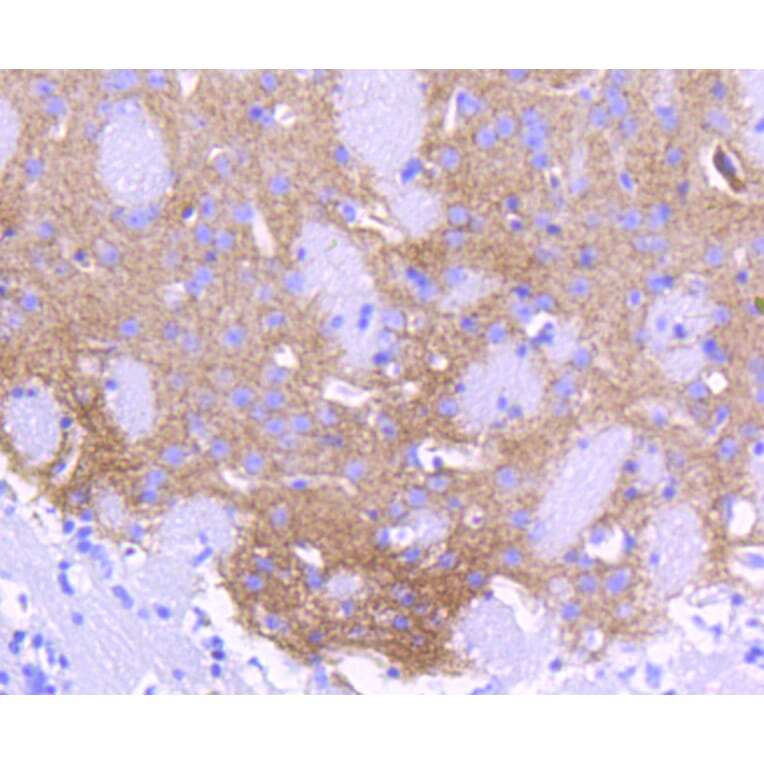 Immunohistochemistry - Anti-ALDH1A1 Antibody (A11132) - Antibodies.com