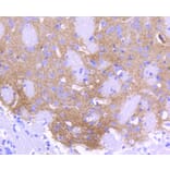 Immunohistochemistry - Anti-ALDH1A1 Antibody (A11132) - Antibodies.com