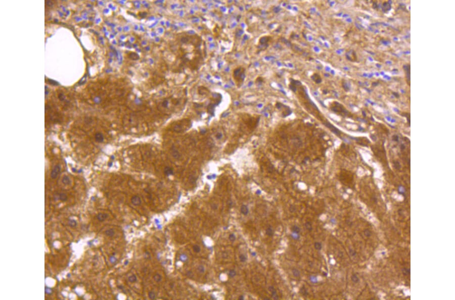 Immunohistochemistry - Anti-ALDH1A1 Antibody (A11132) - Antibodies.com